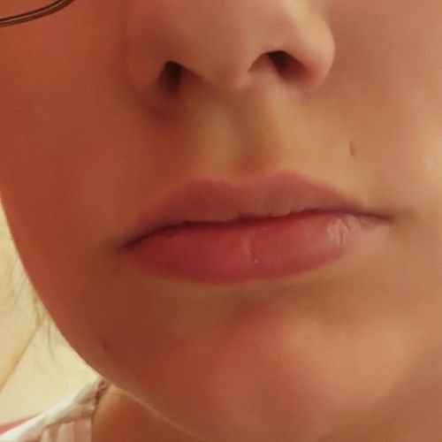 Missculcoquine MYM