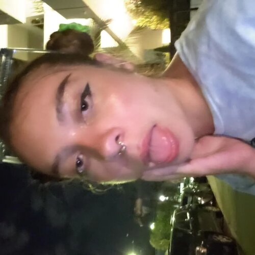 Stella_gardnerella MYM