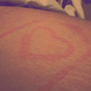 Amorphe mym