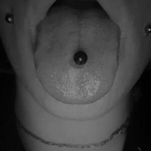 Axl mym