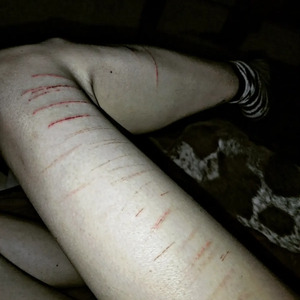 Bdx_sugg_x mym