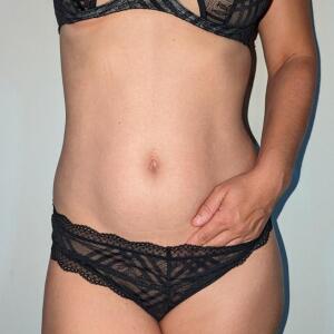 Cassandre_body mym
