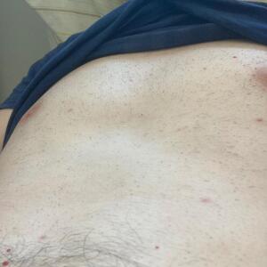 Corentin_skinny mym