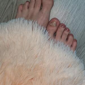 Cox_inelle mym