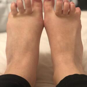 Feet-forever mym