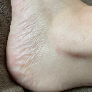 Feetby_mia mym