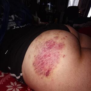 Foxi_666_ mym