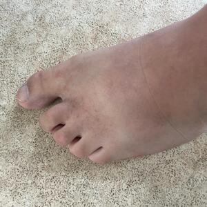 French___foot mym