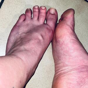 French_beauty_feet mym