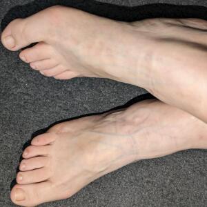 Happy_scar_feet mym