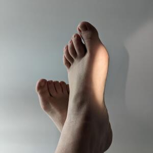 Happy_scar_feet mym