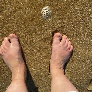 Landiforniafeet mym