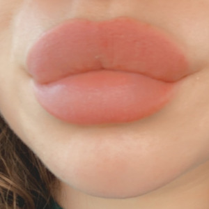 Ll_20 mym