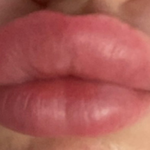 Ll_20 mym