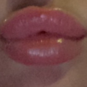 Ll_20 mym