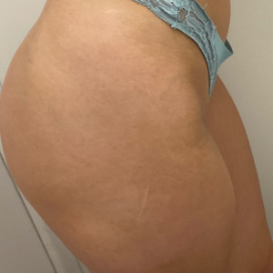 Llachaudasse_louise mym