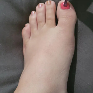 Magmafeet mym