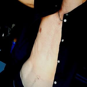 Nierhi_skinny mym