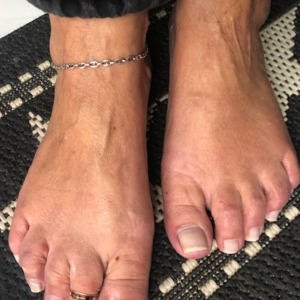 Pieds-dor-mains-dargent mym