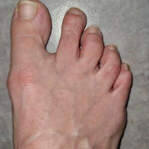 Pieds_chaussettes_culottes mym
