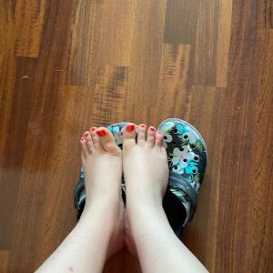 Pieds_dapolline mym