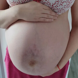 Pregnancyhotgirl mym