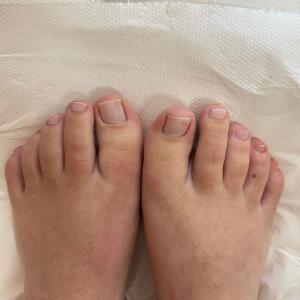 Storyofmyfeet mym
