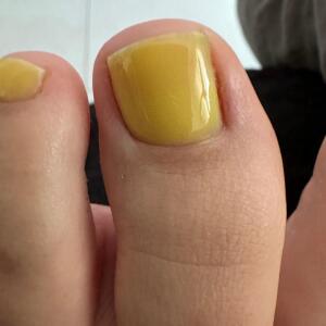 Storyofmyfeet mym