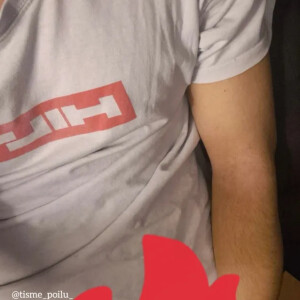 Tisme_poilu_ mym