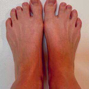 Twin_toes mym
