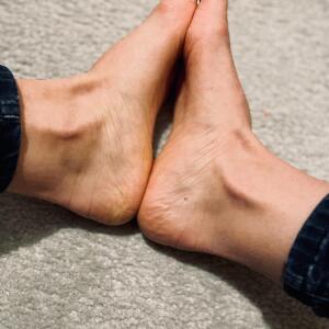 Twin_toes mym