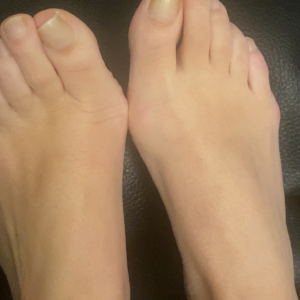 Uglyfeetforyou mym