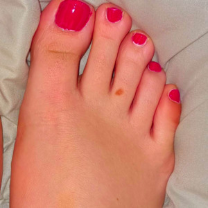 ___myfeet__ mym